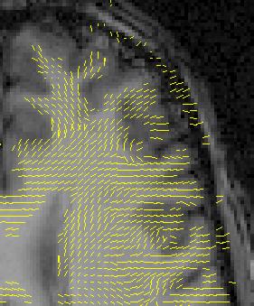 Image of brain slice with vector field overlay.